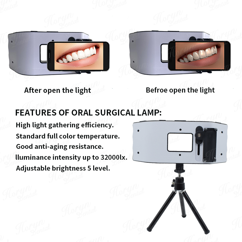 แสงแฟลชทันตกรรมอุปกรณ์ถ่ายภาพท - Photography Lighting Flash บทวิจารณ์และราคา